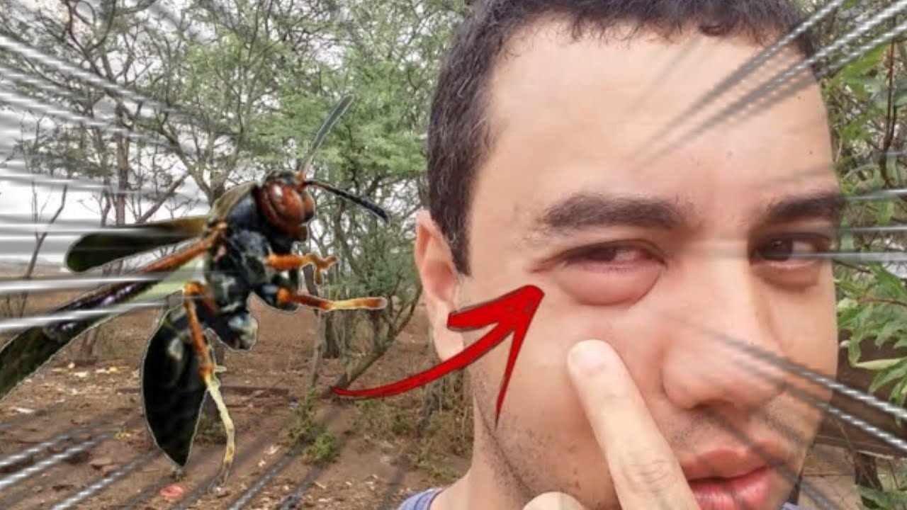 Como Curar a Picada de Marimbondo? O Que Fazer?